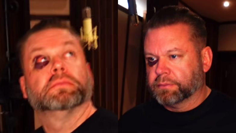 Marek "Maro Music" Walaszek pokazał obrażenia