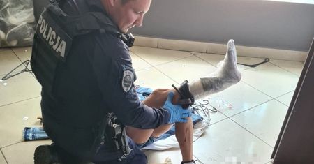 Dramat w sklepie w Świętochłowicach. Lustro rozcięło kobiecie nogę