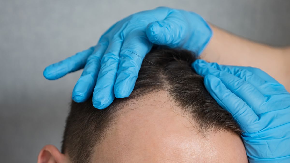 Minoksydyl to substancja czynna obecna w lekach i preparatach dermatologicznych.