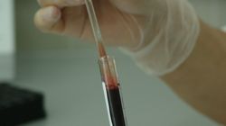 Badania krwi - charakterystyka, skład krwi, normy, interpretacja wyników