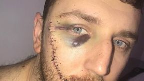 Kibic Evertonu trafiony nożem w twarz. "Nie mogę patrzeć na siebie"