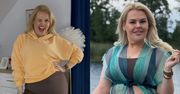 Kinga Zawodnik z dumą prezentuje BRZUCH PO OPERACJI BARIATRYCZNEJ. "To moja skóra, blizny, rany" (ZDJĘCIA)
