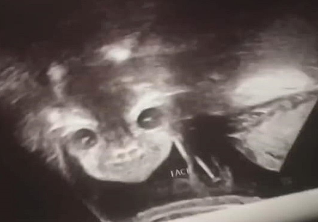 "Diabelskie dziecko" ma już 3 lata. Jak teraz wygląda?