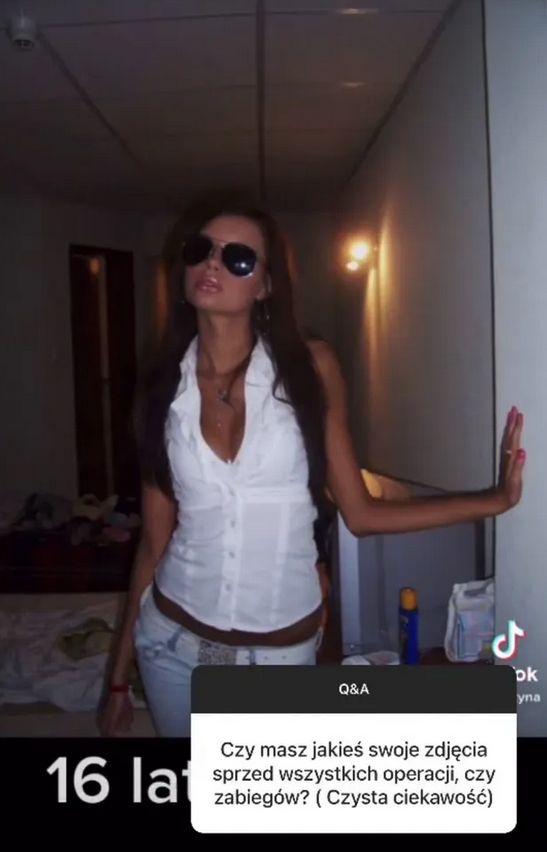 Tak Justyna Gradek wyglądała przed operacjami plastycznymi