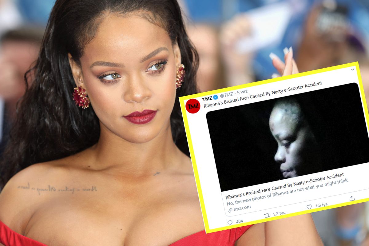 Rihanna pokazała się na mieście z pokiereszowaną twarzą