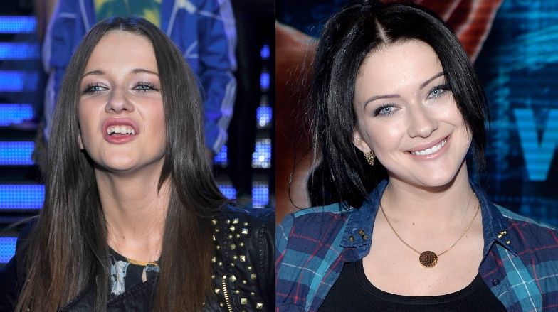 Najdroższe uśmiechy gwiazd