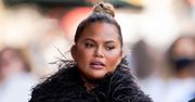 Chrissy Teigen przeszczepiła brwi. Użyła włosów z TYŁU GŁOWY (FOTO)