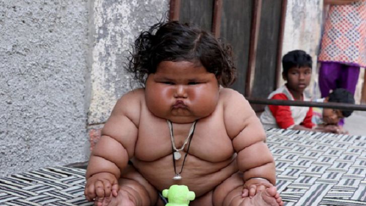 Nie może przestać jeść. Chahat Kumar cierpi na rzadką chorobę