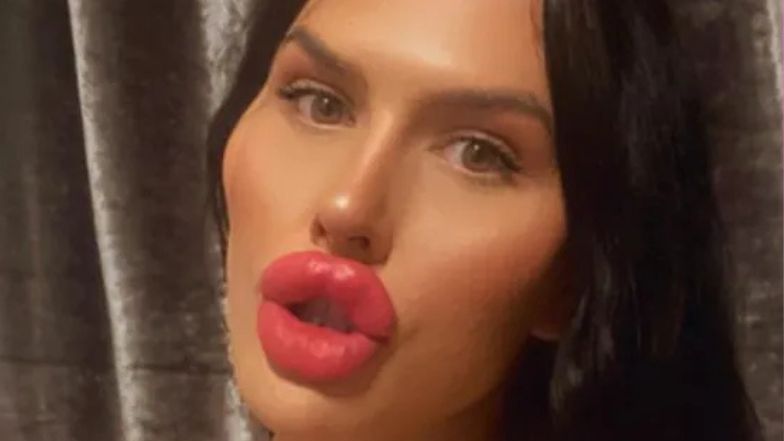 Ma NAJWIĘKSZE USTA w Wielkiej Brytanii