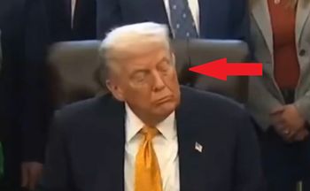 Szokująca diagnoza lekarza. "Trump przeszedł udar"