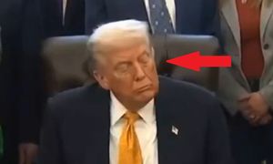 Szokująca diagnoza lekarza. "Trump przeszedł udar"