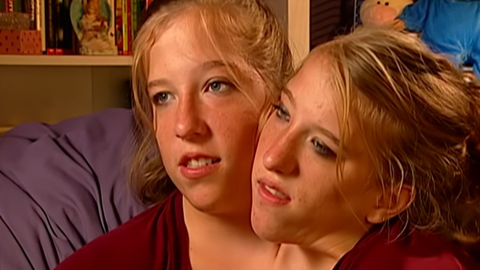 Bliźniaczki syjamskie uczą w szkole