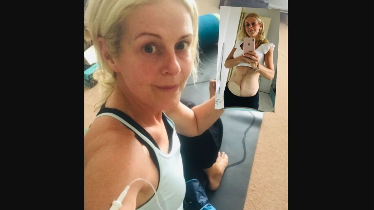 Myślała, że ma zespół jelita drażliwego. Okazało się, że to nowotwór. “Mój świat rozpadł się na kawałki”