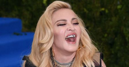 Odważna Madonna pozuje w bieliźnie, pokazując BLIZNĘ i ślady po "bańkach" (FOTO)