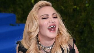 Odważna Madonna pozuje w bieliźnie, pokazując BLIZNĘ i ślady po "bańkach" (FOTO)