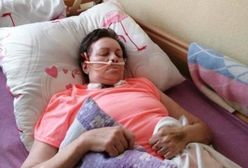 Przeżyła strzał w głowę. Teraz 57-latka walczy o powrót do zdrowia