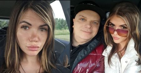 Narzeczona Krzysztofa Skiby zestawiła swoje zdjęcia w makijażu i bez. "Na obu piękna" (FOTO)