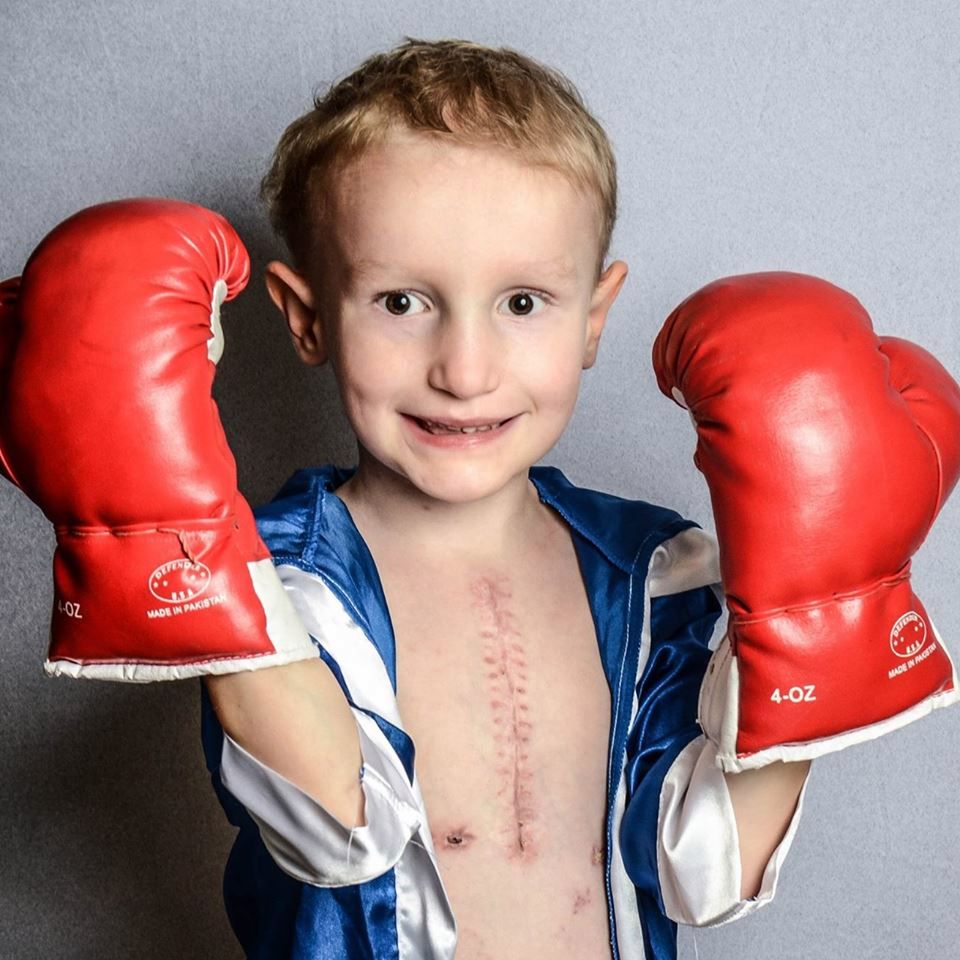 Po chorobie pozostał tylko ślad na klatce piersiowej