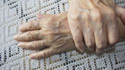 Żyły na rękach - co warto wiedzieć?