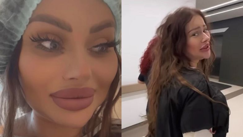 Ewel0na relacjonuje kolejną operację plastyczną w Turcji