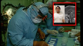 Objawem było podwójne widzenie. Gdy pojawił się rak, pomogło 113 dawców