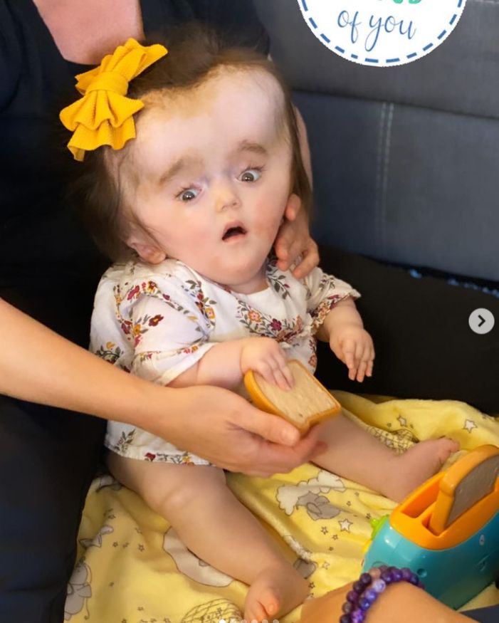 Luna cierpi na rzadką chorobę