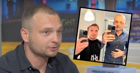 Po przeszczepie włosów twarz influencera spuchła. O tym nie mówią polskie gwiazdy