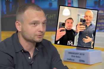Po przeszczepie włosów twarz influencera spuchła. O tym nie mówią polskie gwiazdy