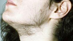 Charakterystyczny objaw pojawia się na szyi. Sygnał, że rak zaatakował