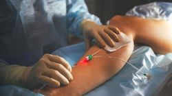 Żylaki szpecą nogi? Nie czekaj, aż rozwinie się zakrzepica