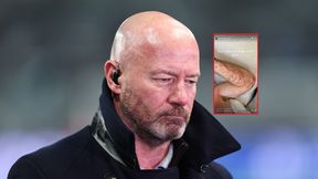 Niebezpieczny upadek legendy. Takich doznał obrażeń