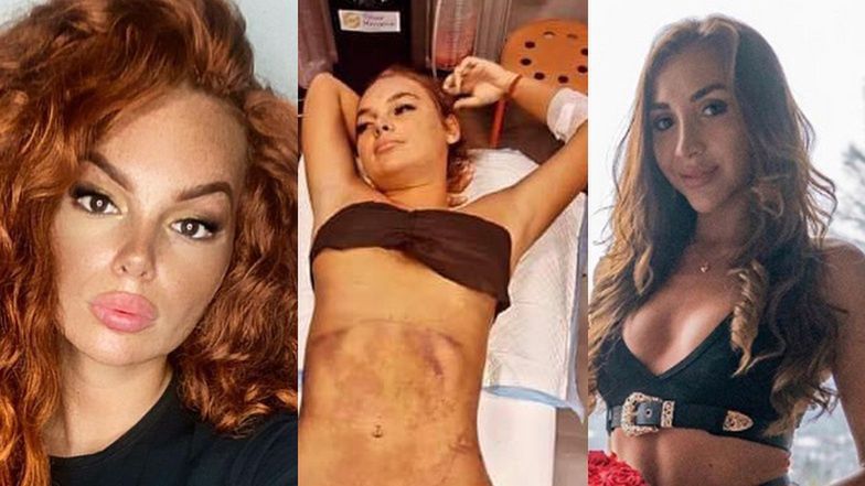 Nathalia i Justyna z "Hotelu Paradise"  znowu poprawiają wygląd 