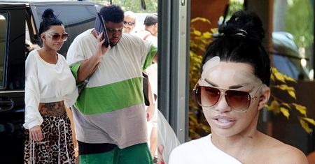 Obolała Katie Price wyłania się z tureckiej kliniki tuż po wykonaniu SZÓSTEGO liftingu twarzy (ZDJĘCIA)