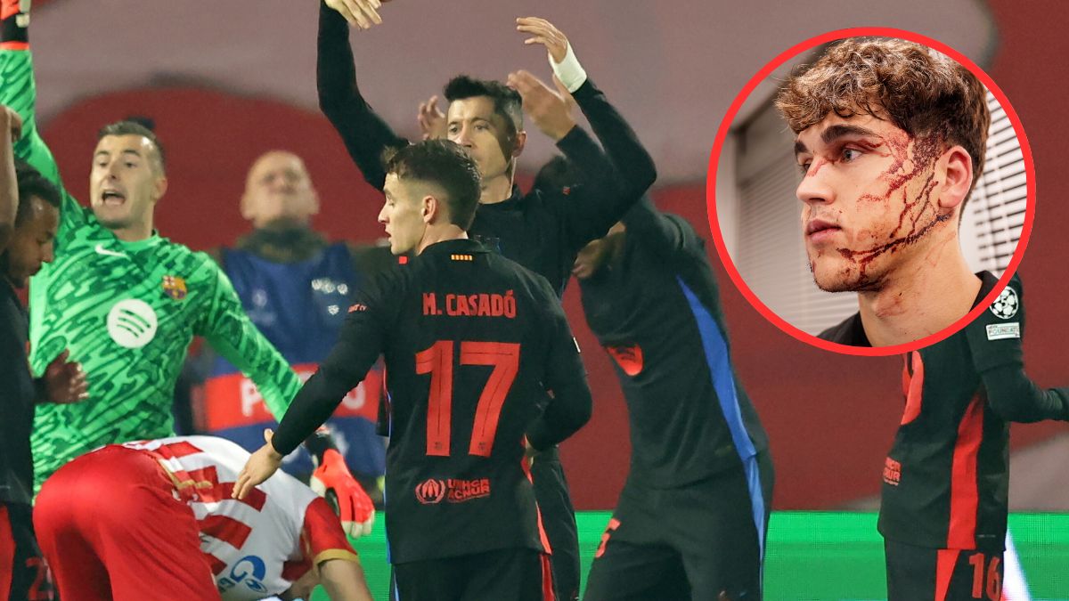 Pau Cubarsi ucierpiał w trakcie meczu Ligi Mistrzów