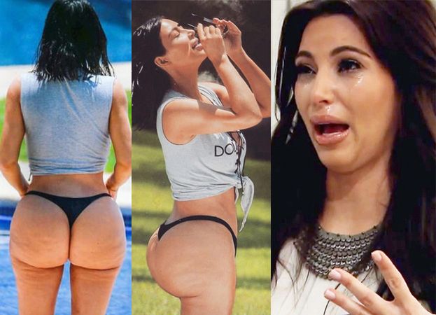 Chirurg plastyczny o cellulicie na pupie Kim: "Okropne! Już nigdy się go nie pozbędzie"