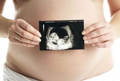 Zabiegi kosmetyczne w ciąży. Co wolno a czego nie wolno w ciąży?
