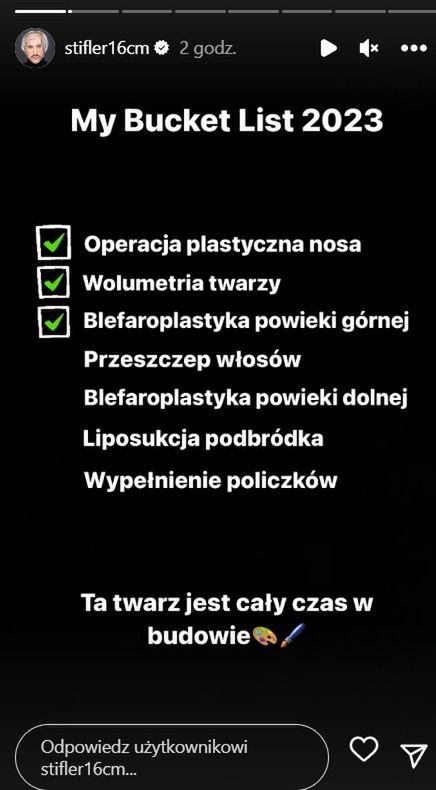 Stifler pokazał twarz po operacjach plastycznych