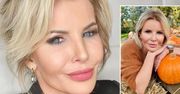 Joanna Racewicz wskazała ulubiony zabieg medycyny estetycznej. Nie zmienia rysów twarzy – a to tylko początek jego zalet!
