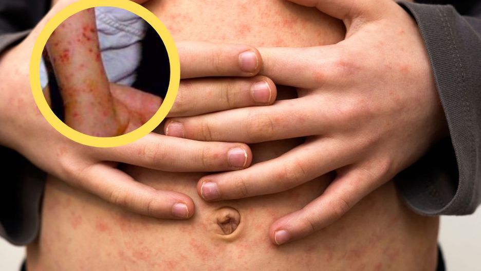 Dwusekundowy trik. Ta prosta metoda może ocalić życie