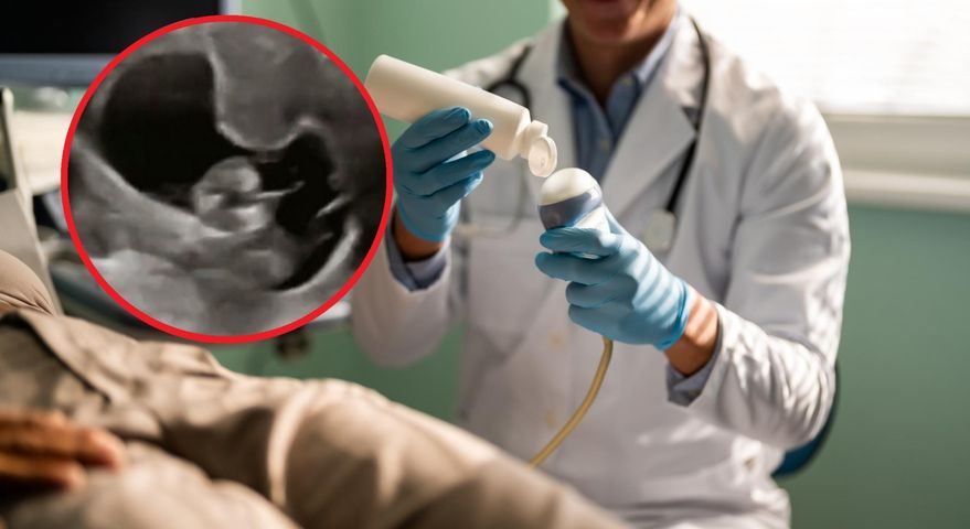 Badanie ultrasonograficzne uchwyciło moment, w którym płód ma czkawkę