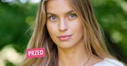 Wow! Patrycja Sobolewska z "Top Model" zakończyła metamorfozę. Wygląda o wiele lepiej niż w programie