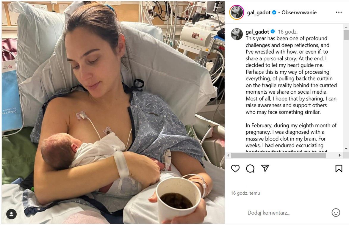 Gal Gadot opowiedziała o trudnym porodzie