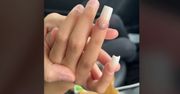 Mama 10-latki ostrzega. Mówi, co się stało z paznokciami jej córki