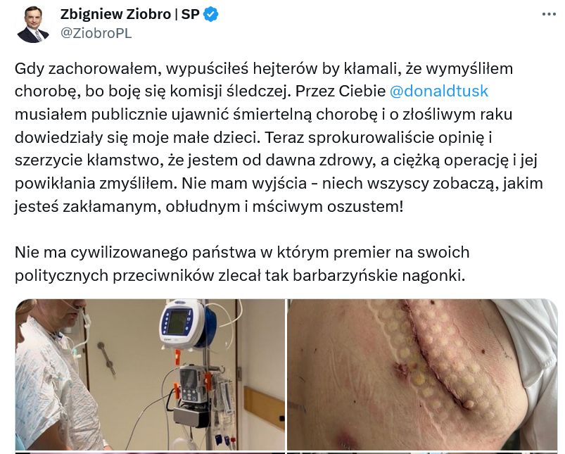 Zbigniew Ziobro opublikował bardzo osobiste zdjęcia