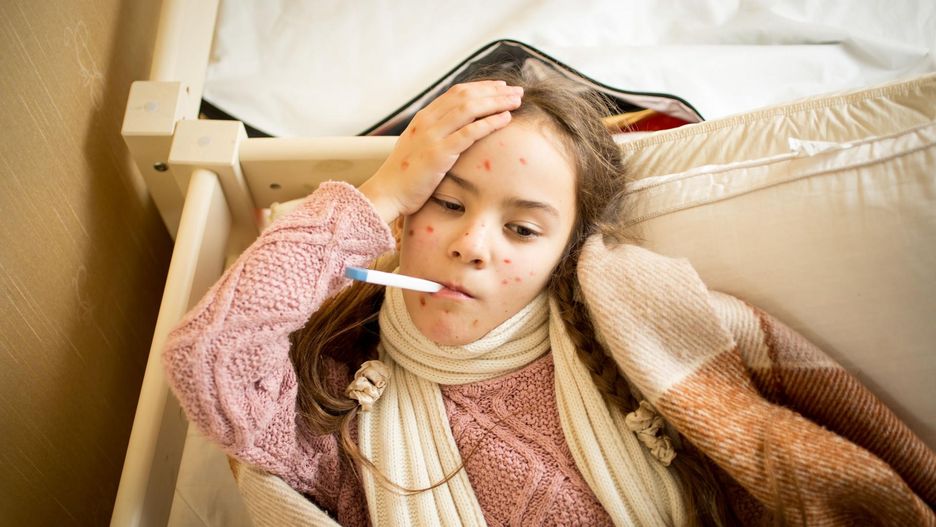 Co warto wiedzieć o ospie wietrznej?