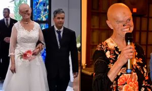 Brazylijka ma za sobą 93 biopsje i 73 nowotwory. Kobieta w szpitalu poznała partnera i wyszła za mąż (FOTO)
