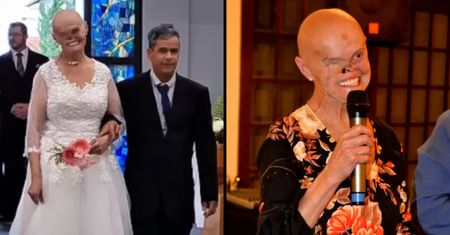 Brazylijka ma za sobą 93 biopsje i 73 nowotwory. Kobieta w szpitalu poznała partnera i wyszła za mąż (FOTO)