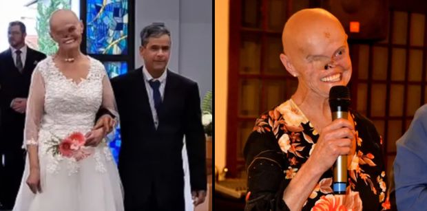 Brazylijka ma za sobą 93 biopsje i 73 nowotwory. Kobieta w szpitalu poznała partnera i wyszła za mąż (FOTO)