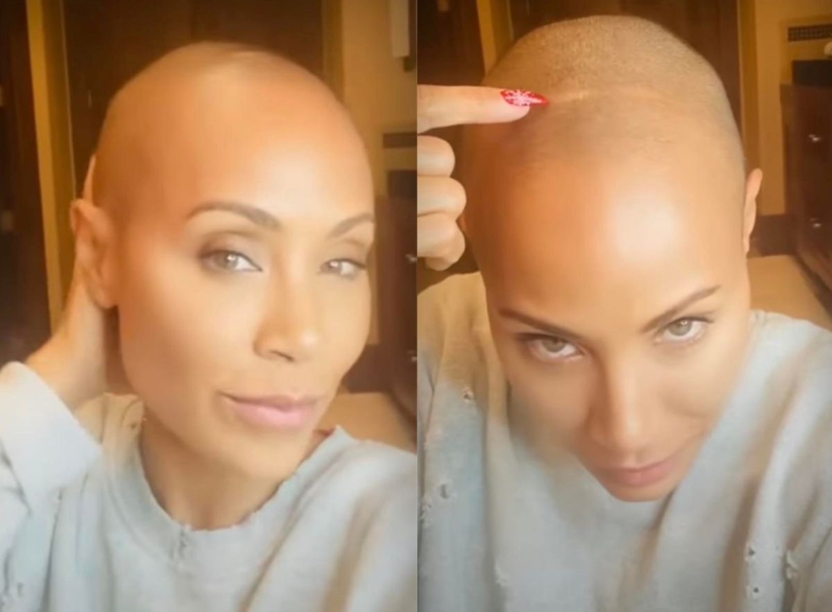 Jada Pinkett Smith cierpi na łysienie 