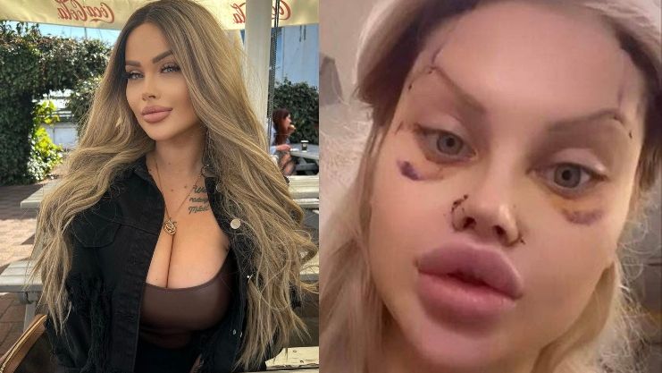 Ewelona otwarcie o kompleksach i operacjach plastycznych